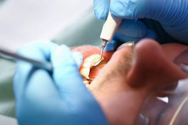 Best Emergency Treatment for Dental Infections or Abscesses in Holmen, WI