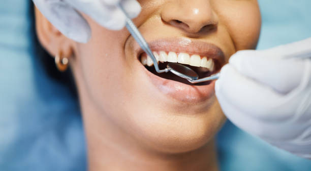 Best Cosmetic Emergency Dentistry in Holmen, WI